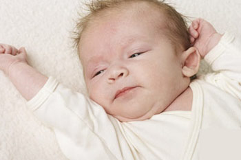 识别新生儿20种特殊生理状况