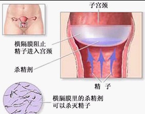避孕方法,避孕工具大pk-搜狐母婴